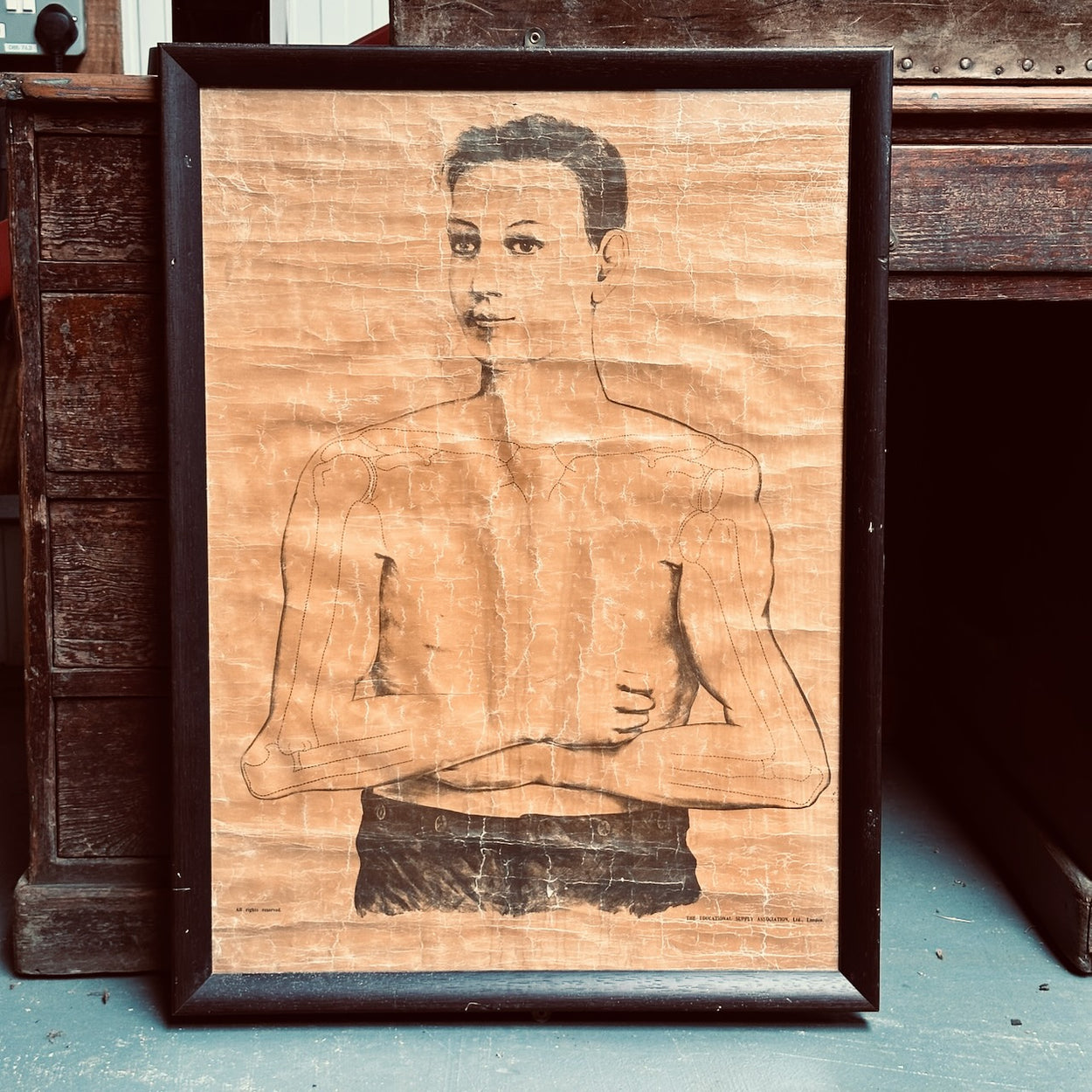 Framed Anatomical Dislocations Teaching Chart