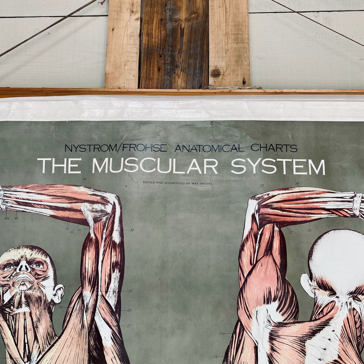 Vintage Nystrom & Frohse Anatomical Chart Of The Muscular System